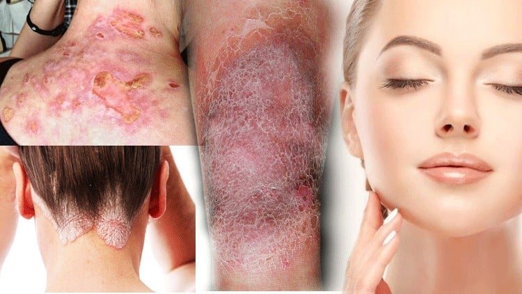 Certificate In Skin Disorders Alternative Therapy Treatment preview